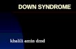 20. khalili   down syndrome