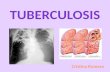 Tuberculosis Ecuador TB
