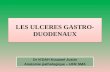 Les ulceres gastro duodenaux. irep pptx (1)