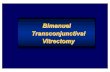Ovali  bimanual transconjunctional virectomy