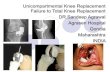 TKR For Failed Uniknee Replacement Surgery Dr Sandeep Agrawal Agrasen Hospital Gondia Maharashtra India