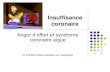 Syndrome coronarien aigu new (1)