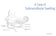A case of submandibular swelling
