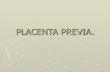 Placenta Previa Y Dppni