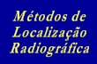 Metodos de localização radiográfica