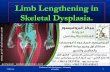 تطويل قصار القامه - Lengthening in skl.dysplasia  - البروفيسور فريح ابوحسان
