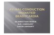 Avn bradycardia mediated
