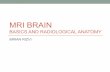 MRI brain; Basics and Radiological Anatomy