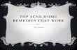 Top acne home remedies that work