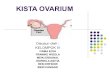 Contoh kista ovarium
