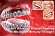 Should I Have the Dentist Replace My Silver Mercury Fillings?