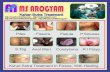 Fistula treatment by kshar sutra hospital center