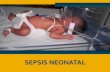 Sepsis neonatal final