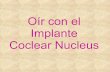 Oir con el implante coclear nucleus2