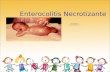 Enterocolitis nectotizante   exposicion