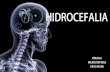 Hidrocefalia full