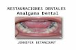 Restauraciones dentales en amalgama