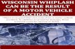 Wisconsin Whiplash Can Be the Result of Motor Vehicle Accident