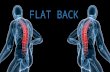 Flat back syndrome
