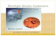 Benign brain tumours