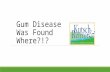 Gum Disease Was Found WHERE?! 6 Risk Factors For Gum Disease
