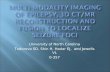 Epilepsy Presentation 3D CT MR Merge for Surgical GuidanceNEWEDIT