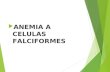 Anemia de las celulas falciforme