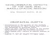 Developmental Defects of the Oral and Maxillofacial Region Edit