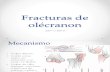 Fracturas de olécranon - tratamiento quirúrgico