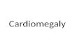 Cardiomegaly, Radiology
