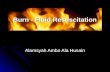 Burn Fluid Resuscitation
