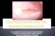 Colposcopia Digital - Dr Egberto Sagastume