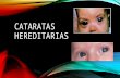 CATARATAS HEREDITARIAS