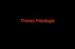 Thorax Patologis.ppt