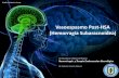 Neurocx - Vasoespasmo 3