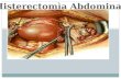 Histerectomia total abdominal