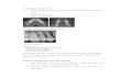 Rontgen Periostitis pada Rongga Mulut