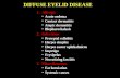 03Diffuse Eyelid Diseases