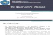 SLIDE PP de Quervain’s Disease