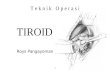 Teknik Operasi Tiroid 2