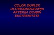 Color Duplex Ultrasonografija Arterija Donjih Ekstremiteta