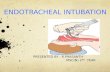 Endotracheal tube insertion ppt