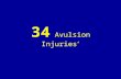 34 avulsion injuries