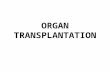 [Gen. surg] organ transplantation from SIMS Lahore