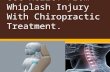 Get relief from whiplash injury with chiropractic treatment