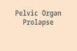 Pelvic Organ Prolapse Treatment in kerala | Top Gynecologist in India