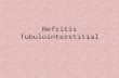 Nefritis Interstitial