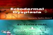 Ectodermal Dysplasia-EGUILLION.pptx