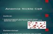 Anemia Sickle Cell