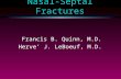 Nasal-Septal Fractures Francis B. Quinn, M.D. Herve’ J. LeBoeuf, M.D.